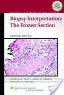Biopsy Interpretation