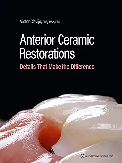 ANTERIOR CERAMIC RESTORATIONS