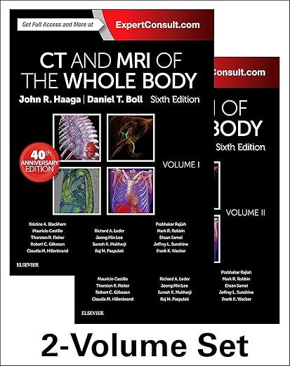 CT and MRI of the Whole Body