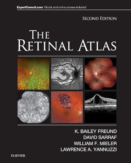 Retinal Atlas
