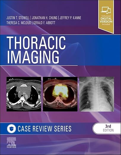 Thoracic Imaging