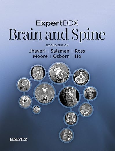 ExpertDDx : Brain and Spine