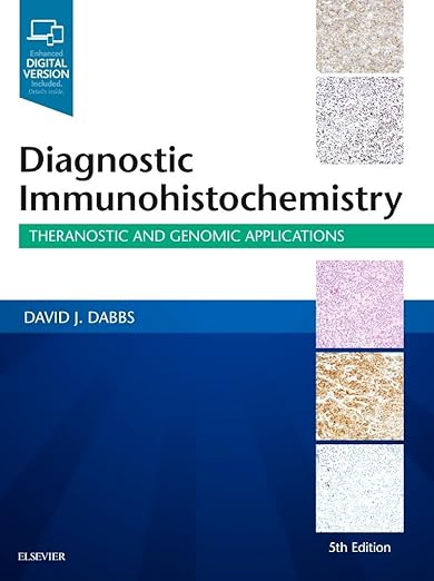 Diagnostic Immunohistochemistry: Theranostic and Genomic Applications