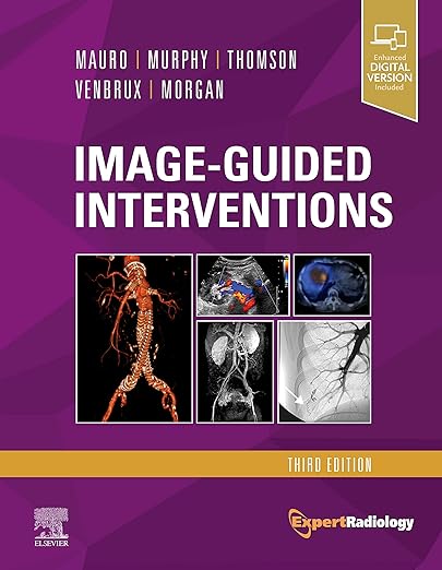 Image-Guided Interventions