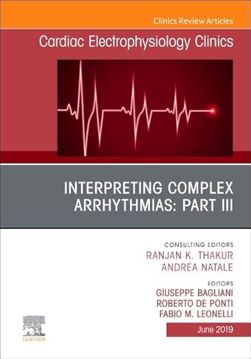Interpreting Complex Arrhythmias