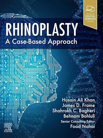 Rhinoplasty