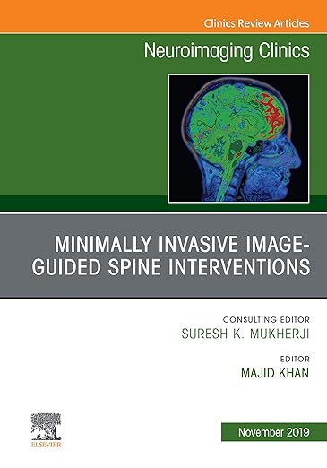 Spine Intervention, an Issue of Neuroimaging Clinics of North America