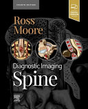 Diagnostic Imaging: Spine