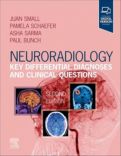 Neuroradiology