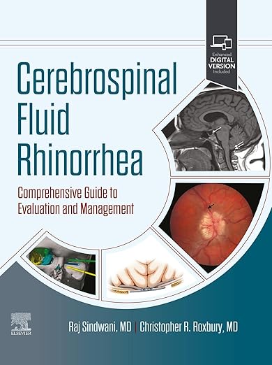 Cerebrospinal Fluid Rhinorrhea - E-Book: Comprehensive Guide to Evaluation and Management