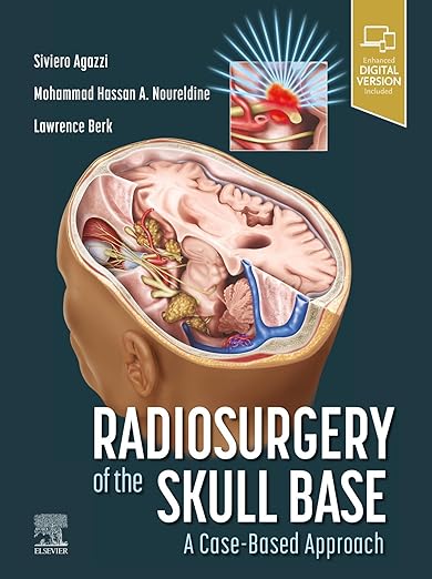 Radiosurgery of the Skull Base