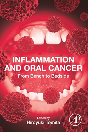 Inflammation and Oral Cancer