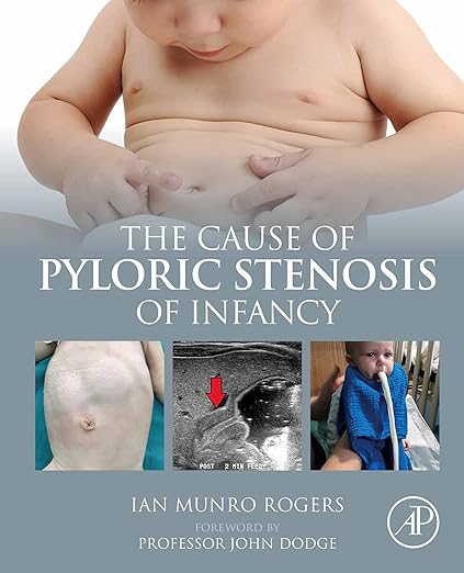 Cause of Pyloric Stenosis of Infancy