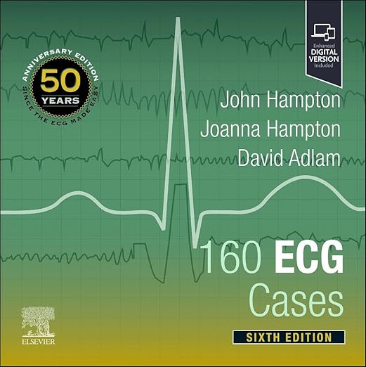 160 ECG Cases