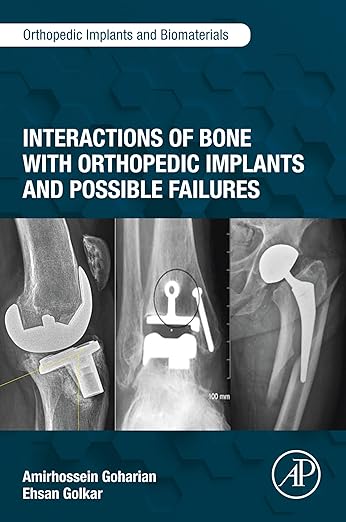 Interactions of Bone with Orthopedic Implants and Possible Failures