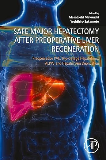 Safe Major Hepatectomy after Preoperative Liver Regeneration