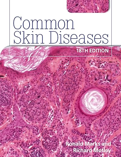 Common Skin Diseases 18th edition: ISE