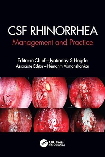 CSF Rhinorrhoea: Management and Practice