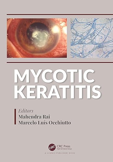 Mycotic Keratitis