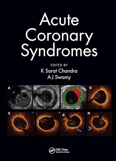 Acute Coronary Syndromes