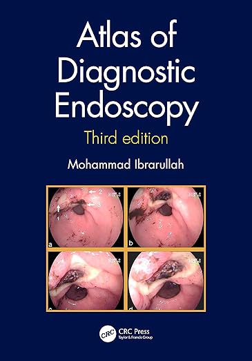 Atlas of Diagnostic Endoscopy