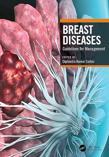 Breast Diseases