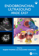 Endobronchial Ultrasound