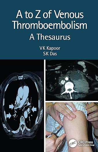 to Z of Venous Thrombo-Embolism