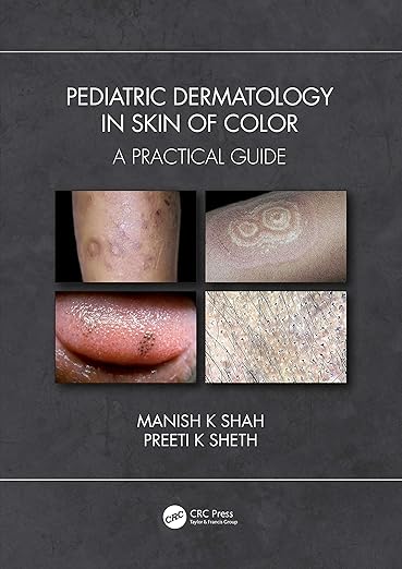 Pediatric Dermatology in Darker Skin