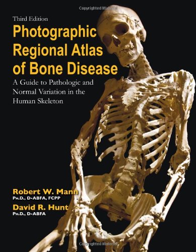 Photographic regional atlas of bone disease