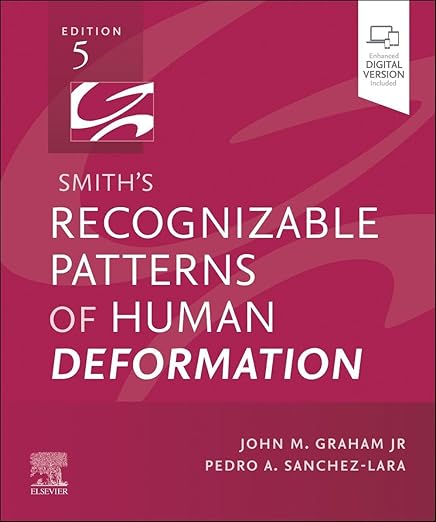 Smiths Recognizable Patterns in Human Deformation