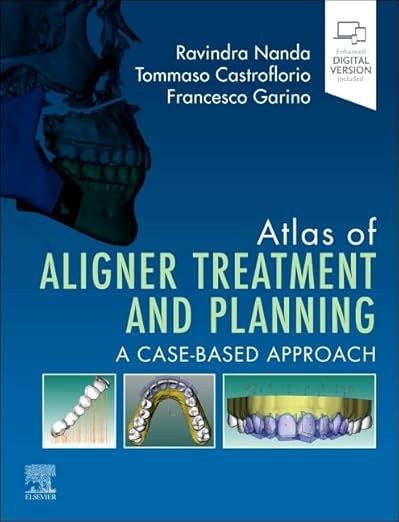 Atlas of Aligner Treatment and Planning: A Case-based Approach
