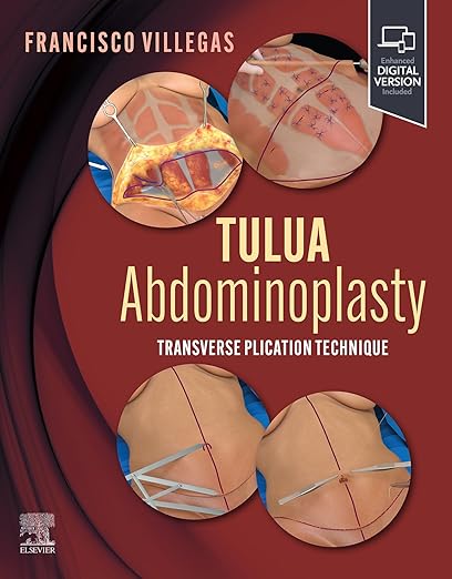 TULUA Abdominoplasty