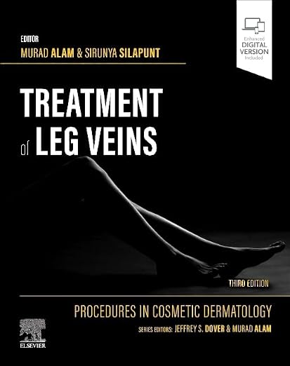 Procedures in Cosmetic Dermatology Series: Treatment of Leg Veins