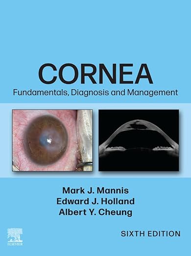 Cornea, 2-Volume Set - E-Book