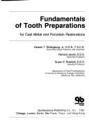 Fundamentals of tooth preparations for cast metal and porcelain restorations
