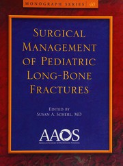 Surgical Management of Pediatric Long Bone Fractures