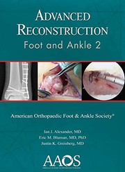 Advance Reconstruction