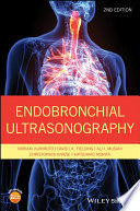 Endobronchial Ultrasonography