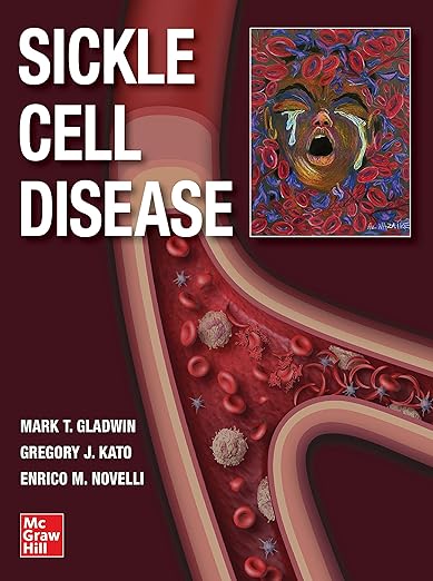 Sickle Cell Disease