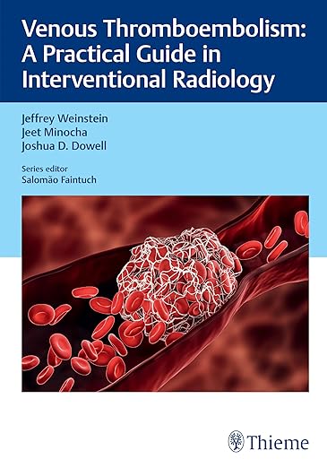 Venous Thromboembolism: A Practical Guide in Interventional Radiology