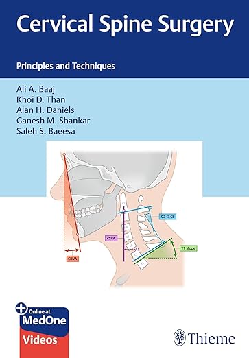 Cervical Spine Surgery