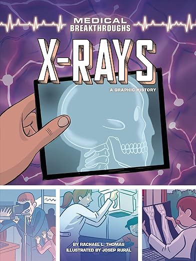 X-Rays