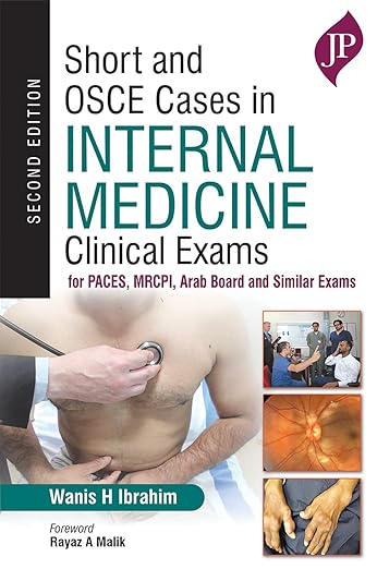 Short and Osce Cases Internal Medicine