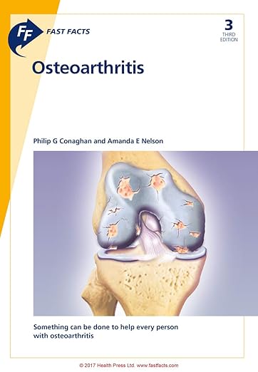 Osteoarthritis