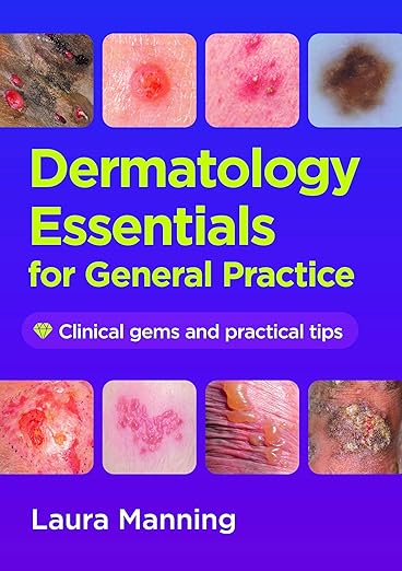 Dermatology Essentials for General Practice