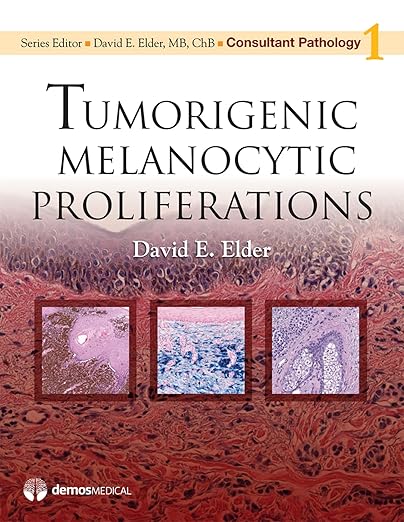 Tumorigenic melanocytic proliferations