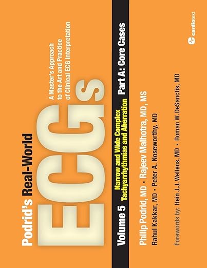Podrid's Real-World ECGs