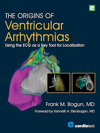 Origins of Ventricular Arrhythmias