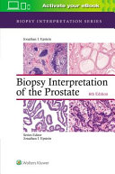 Biopsy Interpretation of Prostate 6
